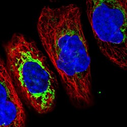 Invitrogen TMCO6 Polyclonal Antibody 100 &mu;L; Unconjugated:Antibodies,