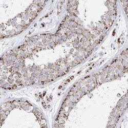 Invitrogen TMCO6 Polyclonal Antibody 100 &mu;L; Unconjugated:Antibodies,