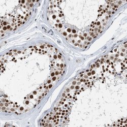 FIP1L1 Polyclonal Antibody, Invitrogen 100 &mu;L; Unconjugated:Antibodies,