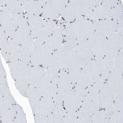 FIP1L1 Polyclonal Antibody, Invitrogen 100 &mu;L; Unconjugated:Antibodies,