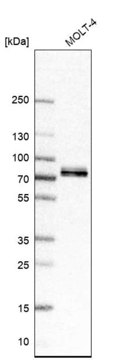 Invitrogen FIP1L1 Polyclonal Antibody 100 &mu;L | Buy Online | Invitrogen&trade; | Fisher Scientific