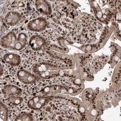 Invitrogen RBM17 Polyclonal Antibody 100 &mu;L; Unconjugated:Antibodies,