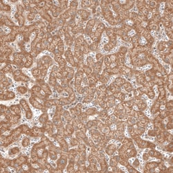 Invitrogen MICU1 Polyclonal Antibody 100 &mu;L | Buy Online | Invitrogen&trade; | Fisher Scientific