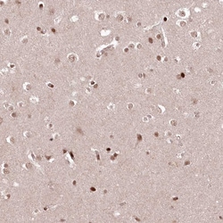 Invitrogen CCSER2 Polyclonal Antibody 100 &mu;L; Unconjugated:Antibodies,