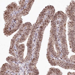 Invitrogen CCSER2 Polyclonal Antibody 100 &mu;L; Unconjugated:Antibodies,