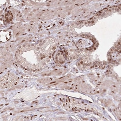 Invitrogen CCSER2 Polyclonal Antibody 100 &mu;L; Unconjugated:Antibodies,