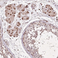 Invitrogen CCSER2 Polyclonal Antibody 100 &mu;L; Unconjugated:Antibodies,