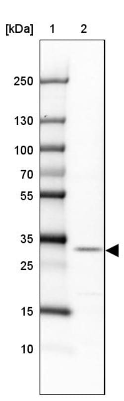 Invitrogen CCSER2 Polyclonal Antibody 100 &mu;L; Unconjugated:Antibodies,