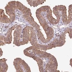 Invitrogen CCSER2 Polyclonal Antibody 100 &mu;L; Unconjugated:Antibodies,