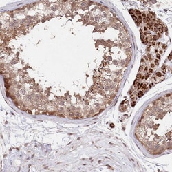 Invitrogen CCSER2 Polyclonal Antibody 100 &mu;L; Unconjugated:Antibodies,