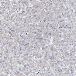 Invitrogen MPP9 Polyclonal Antibody 100 &mu;L; Unconjugated:Anticorps,