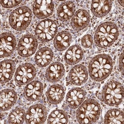 Invitrogen DNA2 Polyclonal Antibody 100 &mu;L | Buy Online | Invitrogen&trade; | Fisher Scientific