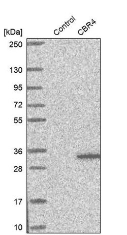 Invitrogen CBR4 Polyclonal Antibody 100 &mu;L; Unconjugated:Antibodies,