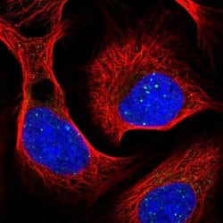 Invitrogen RAP80 Polyclonal Antibody 100 &mu;L; Unconjugated:Antibodies,