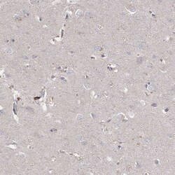 Invitrogen RAP80 Polyclonal Antibody 100 &mu;L; Unconjugated:Antibodies,