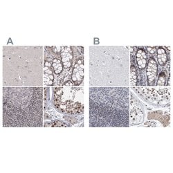 Invitrogen RAP80 Polyclonal Antibody 100 &mu;L; Unconjugated:Antibodies,