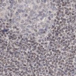 Invitrogen RAP80 Polyclonal Antibody 100 &mu;L; Unconjugated:Antibodies,