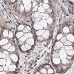 Invitrogen RAP80 Polyclonal Antibody 100 &mu;L; Unconjugated:Antibodies,