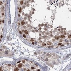 Invitrogen RAP80 Polyclonal Antibody 100 &mu;L; Unconjugated:Antibodies,