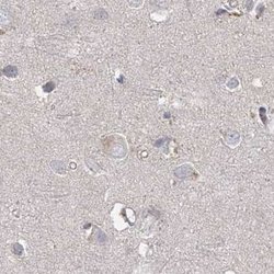 Invitrogen RAP80 Polyclonal Antibody 100 &mu;L; Unconjugated:Antibodies,