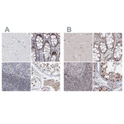 Invitrogen RAP80 Polyclonal Antibody 100 &mu;L; Unconjugated:Antibodies,