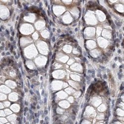 Invitrogen RAP80 Polyclonal Antibody 100 &mu;L; Unconjugated:Antibodies,