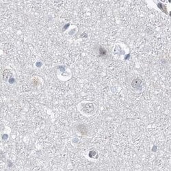 Invitrogen RAP80 Polyclonal Antibody 100 &mu;L; Unconjugated:Antibodies,
