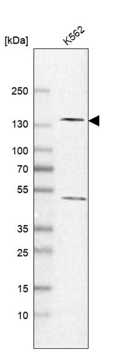 Invitrogen POLR2B Polyclonal Antibody 100 &mu;L; Unconjugated:Antibodies,