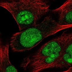 Invitrogen TSSK3 Polyclonal Antibody 100 &mu;L; Unconjugated:Antibodies,