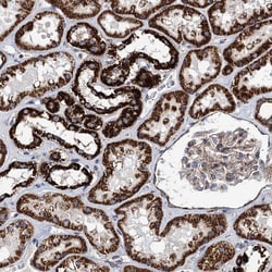 Invitrogen TSSK3 Polyclonal Antibody 100 &mu;L; Unconjugated:Antibodies,