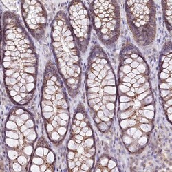 Invitrogen ZFYVE27 Polyclonal Antibody 100 &mu;L; Unconjugated:Antibodies,