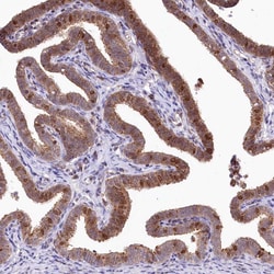 Invitrogen ZFYVE27 Polyclonal Antibody 100 &mu;L; Unconjugated:Antibodies,