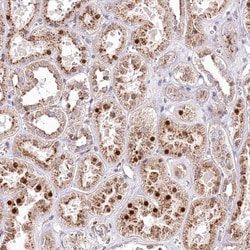 Invitrogen ZFYVE27 Polyclonal Antibody 100 &mu;L; Unconjugated:Antibodies,