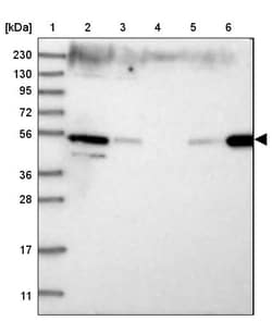 Invitrogen ZFYVE27 Polyclonal Antibody 100 &mu;L; Unconjugated:Antibodies,