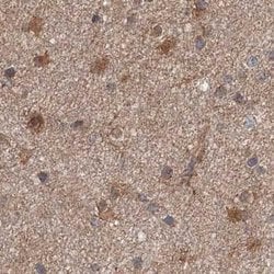 Invitrogen DDO Polyclonal Antibody 100 &mu;L | Buy Online | Invitrogen&trade; | Fisher Scientific