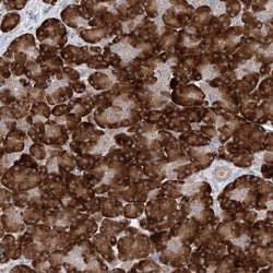 Invitrogen MMADHC Polyclonal Antibody 100 &mu;L | Buy Online | Invitrogen&trade; | Fisher Scientific