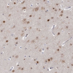 Invitrogen USP11 Polyclonal Antibody 100 &mu;L; Unconjugated:Antibodies,