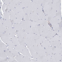 Invitrogen USP11 Polyclonal Antibody 100 &mu;L; Unconjugated:Antibodies,