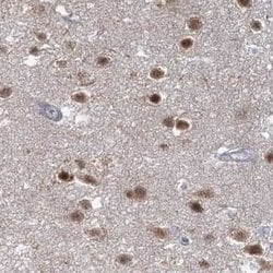 Invitrogen USP11 Polyclonal Antibody 100 &mu;L; Unconjugated:Antibodies,