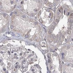 Invitrogen USP11 Polyclonal Antibody 100 &mu;L; Unconjugated:Antibodies,