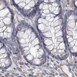 Invitrogen USP11 Polyclonal Antibody 100 &mu;L; Unconjugated:Antibodies,