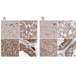 Invitrogen MKRN2 Polyclonal Antibody 100 &mu;L; Unconjugated:Antibodies,