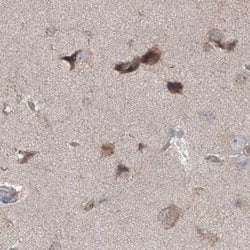 Invitrogen MKRN2 Polyclonal Antibody 100 &mu;L; Unconjugated:Antibodies,