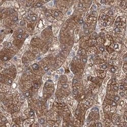 Invitrogen MKRN2 Polyclonal Antibody 100 &mu;L; Unconjugated:Antibodies,