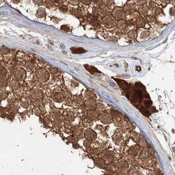 Invitrogen MKRN2 Polyclonal Antibody 100 &mu;L; Unconjugated:Antibodies,