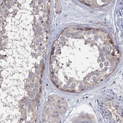 EPB41L5 Polyclonal Antibody, Invitrogen 100 &mu;L; Unconjugated:Antibodies,