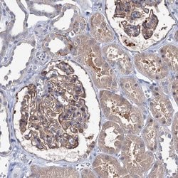 EPB41L5 Polyclonal Antibody, Invitrogen 100 &mu;L; Unconjugated:Antibodies,