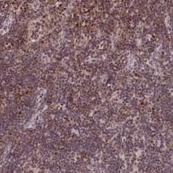 Invitrogen POLA2 Polyclonal Antibody 100 &mu;L | Buy Online | Invitrogen&trade; | Fisher Scientific