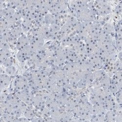 Invitrogen RPP30 Polyclonal Antibody 100 &mu;L; Unconjugated:Antibodies,