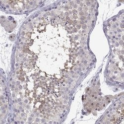 Invitrogen TTC18 Polyclonal Antibody 100 &mu;L; Unconjugated:Antibodies,
